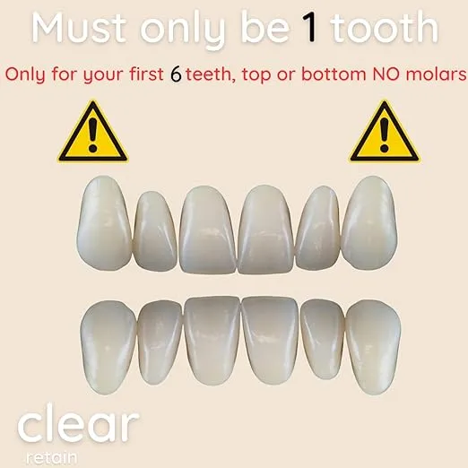 ClearRetain- SINGLE TOOTH Temporary Tooth Replacement Custom Fit For Realistic Look & Color | Removable Temporary Tooth Retainer | Professional Lab Grade Quality Upper Teeth (UPPER)