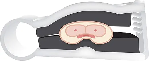 KindKlamp Penile Clamp by Bioderm® for Male Urinary Incontinence